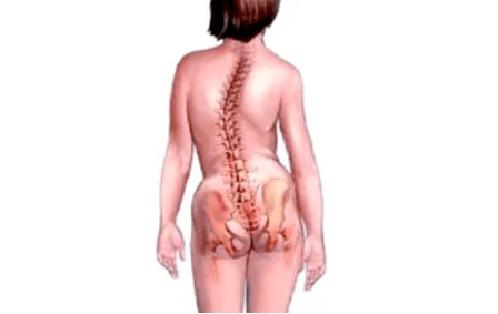 Causes of cervical osteochondrosis