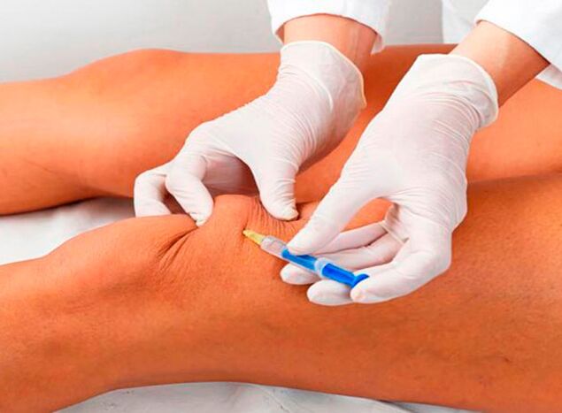 Intra-articular injections of drugs for the treatment of arthrosis of the knee joint